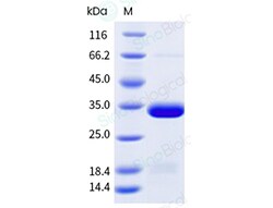 Sino Biological Recombinant Human Carbonic Anhydrase IV/CA4 Protein (His