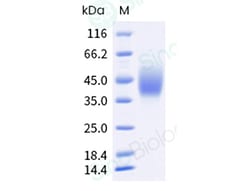 Sino Biological Recombinant Rat B7-1/CD80 Protein (His Tag), HPLC-verified,