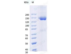 Sino Biological Recombinant Human CD70/CD27 Ligand Protein (hFc Tag), HPLC-verified,