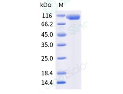 Sino Biological Recombinant Human PSMA/FOLH1 Protein (ECD, His & AVI Tag),