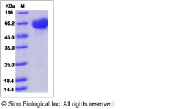 Sino Biological Recombinant Human KIRREL Protein (His Tag), Quantity: Each