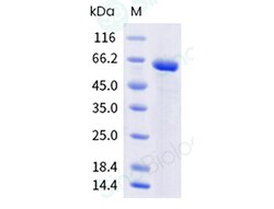 Sino Biological Recombinant Mouse Apolipoprotein A-I/APOA1 Protein (hFc