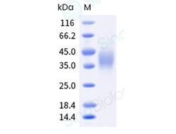 Sino Biological Recombinant Mouse TREM-2 Protein (His & AVI Tag), Biotinylated,
