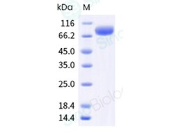 Sino Biological Recombinant Human NPTX2 Protein (ECD, hFc Tag), Quantity:
