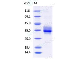 Sino Biological Recombinant Mouse CLL-1/CLEC12A Protein (His Tag), HPLC-verified,