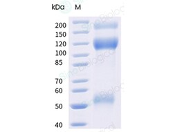 Sino Biological Recombinant Human IGF1R Protein (ECD, His & AVI Tag), Biotinylated,