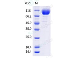 Sino Biological Recombinant Human VCAM-1/CD106 Protein (ECD, His & AVI
