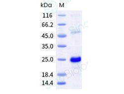 Sino Biological Recombinant Humulus scanden Allergen Hum j 1 250ug, Quantity: