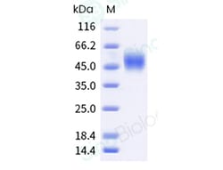 Sino Biological Recombinant Human IL-21 Receptor/IL-21R Protein (His &