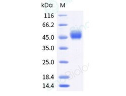 Sino Biological Recombinant Mouse Mesothelin Protein (His & AVI Tag), Biotinylated,