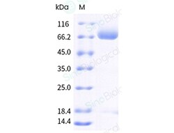 Sino Biological Recombinant Mouse LRRC15 Protein (ECD, His & AVI Tag),