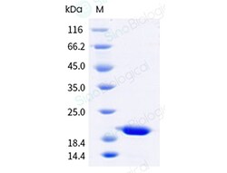 Sino Biological Recombinant Aspergillus Fumigatus Asp f 3 Protein, Quantity: