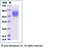 Sino Biological Recombinant Human 5T4/TPBG Protein (His Tag), HPLC-verified,