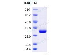 Sino Biological Recombinant Mouse Serum Amyloid P Protein (His Tag), HPLC-verified,