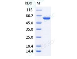 Sino Biological Recombinant Human USP14 Protein (His Tag), Quantity: Each