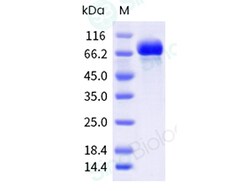 Sino Biological Influenza A H3N2 (A/X-31) Hemagglutinin / HA Protein (ECD,