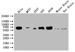 Biomatik Corporation Gba Recombinant Antibody, Quantity: Each of 1