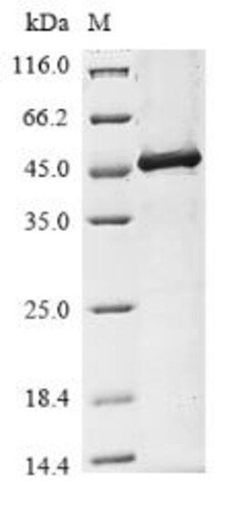Biomatik Corporation Recombinant Human Transmembrane protease serine 2