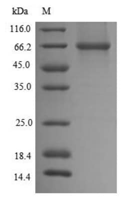 Biomatik Corporation Recombinant Mouse Dihydrolipoyllysine-residue acetyltransferase