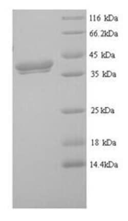 Biomatik Corporation Recombinant Mouse Erythroferrone (Erfe), Quantity: