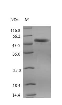 Biomatik Corporation Recombinant Human Receptor-interacting serine/threonine-protein