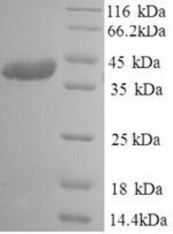 Biomatik Corporation Recombinant Human coronavirus OC43 Spike glycoprotein
