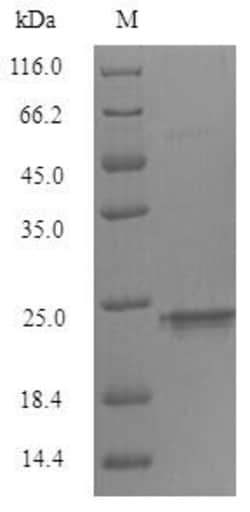 Biomatik Corporation Recombinant Mouse Triggering receptor expressed on