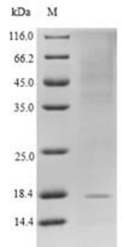 Biomatik Corporation Recombinant Human Glucagon-like peptide 1 receptor