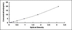 Biomatik Corporation Human Alpha-1-B-Glycoprotein (a1BG) ELISA Kit, Quantity: