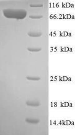 Biomatik Corporation Recombinant Human Interleukin-12 receptor subunit
