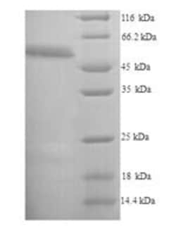 Biomatik Corporation Recombinant Mouse Receptor-interacting serine/threonine-protein