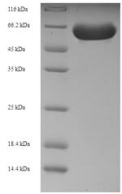 Biomatik Corporation Recombinant Human Receptor-interacting serine/threonine-protein