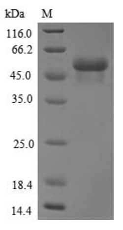 Biomatik Corporation Recombinant Human E3 ubiquitin-protein ligase TRIM21
