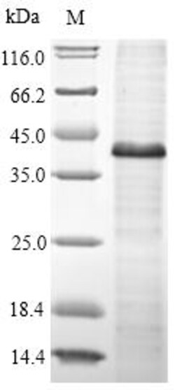 Biomatik Corporation Recombinant Human Protein Wnt-5a (WNT5A), Quantity: