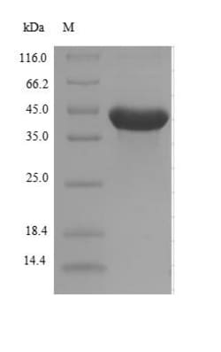 Biomatik Corporation Recombinant Escherichia coli Alpha-ketoglutarate-dependent
