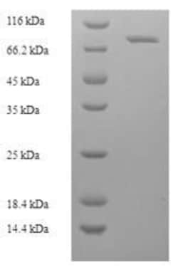 Biomatik Corporation Recombinant Macaca fascicularis albumin (ALB), Quantity: