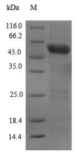 Biomatik Corporation Recombinant Human Cyclic GMP-AMP synthase (CGAS),