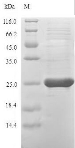 Biomatik Corporation Recombinant Cricetulus griseus Peroxiredoxin-1 (PRDX1),