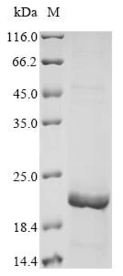 Biomatik Corporation Recombinant Human Mucin-5B (MUC5B), partial, Quantity: