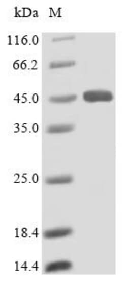 Biomatik Corporation Recombinant Human Lysosomal acid lipase/cholesteryl