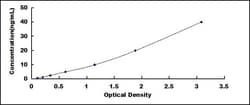 Biomatik Corporation Human Pancreatic Lipase (PL) ELISA Kit, Quantity: