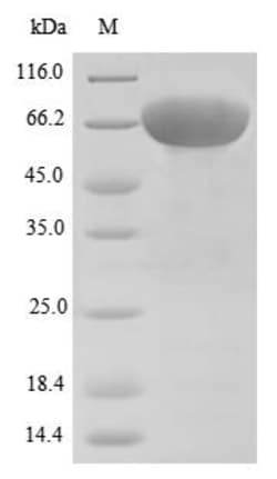 Biomatik Corporation Recombinant Human Desmoglein-3 (DSG3), partial, Quantity: