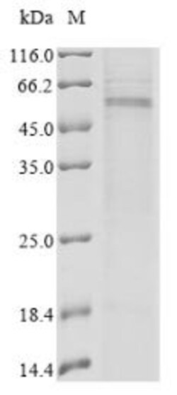 Biomatik Corporation Recombinant Human Transmembrane protease serine 2