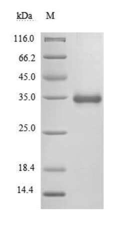 Biomatik Corporation Recombinant Severe acute respiratory syndrome coronavirus