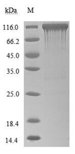 Biomatik Corporation Recombinant Human Angiotensin-converting enzyme 2