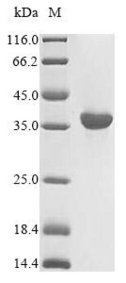 Biomatik Corporation Recombinant Human HLA class I histocompatibility antigen,