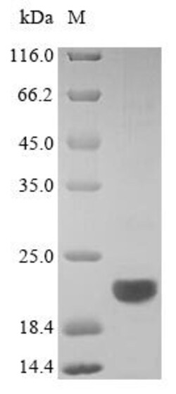 Biomatik Corporation Recombinant Mouse B-lymphocyte antigen CD20 (Ms4a1),