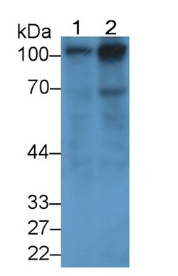 Biomatik Corporation Thrombomodulin (Tm) Monoclonal Antibody, Quantity: