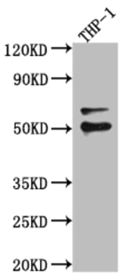 Biomatik Corporation Fli1 Recombinant Antibody, Quantity: Each of 1