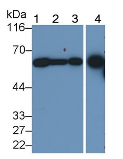 Biomatik Corporation Dipeptidase 1, Renal (Dpep1) Monoclonal Antibody,